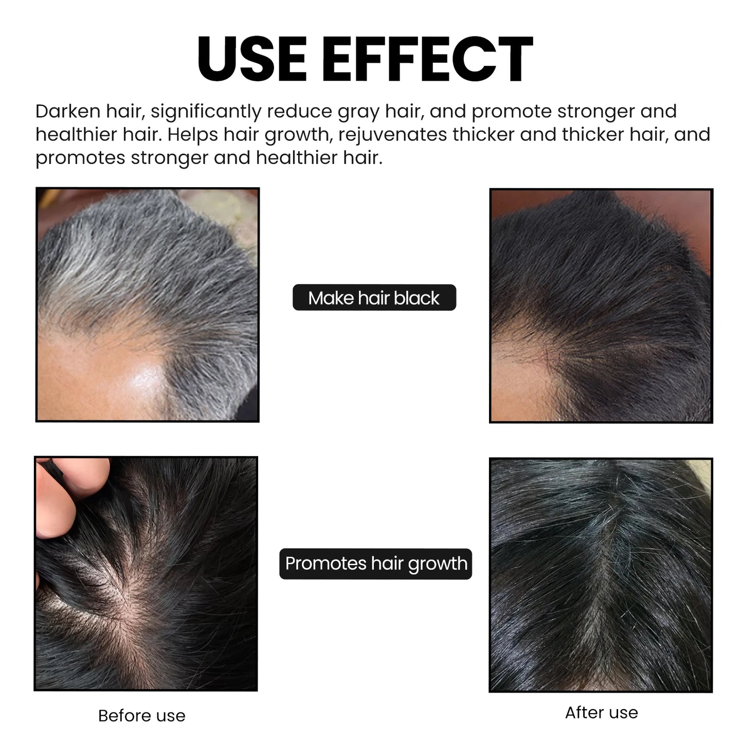CharClean™ Bamboo Charcoal Shampoo Bar – Deep Scalp Detox & Hair Thickening